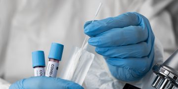 Koronavirusas vėl rodo jėgą