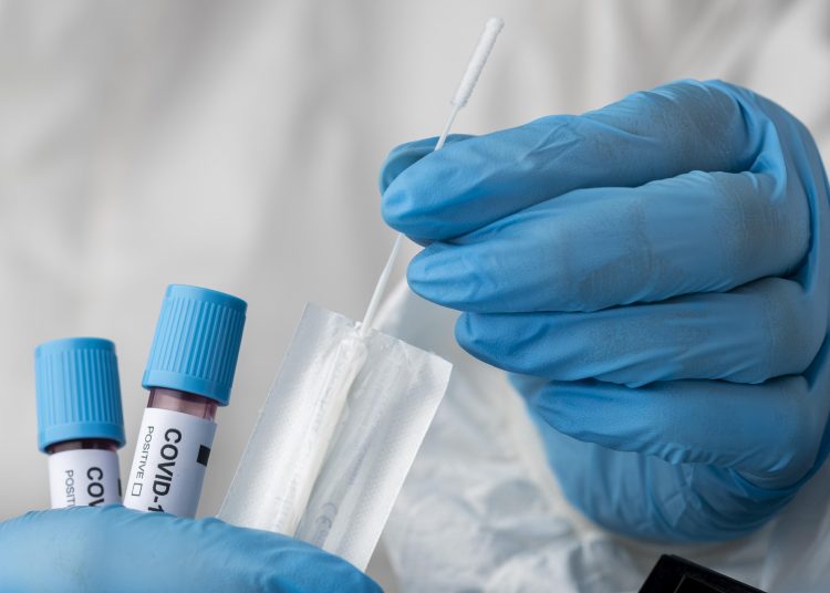 Koronavirusas vėl rodo jėgą