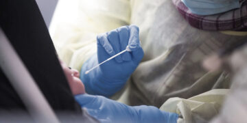 Nemokamo testavimo finišas