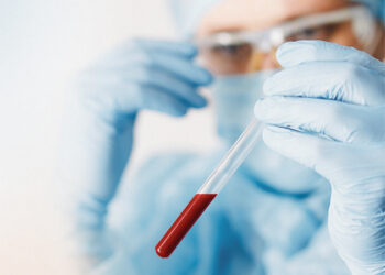 COVID-19 pasitraukimo ženklų nerodo