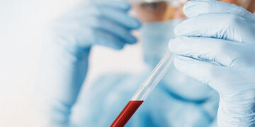 COVID-19 pasitraukimo ženklų nerodo