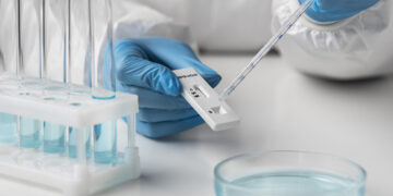 Ryškus sergamumo COVID-19 augimas