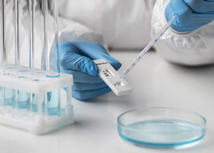 Ryškus sergamumo COVID-19 augimas