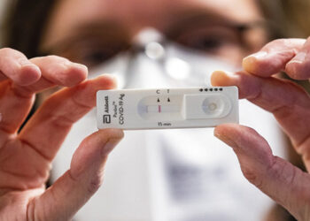 Vienų testų pritrūko, prie kitų nutįso eilės