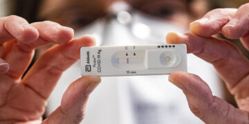 Vienų testų pritrūko, prie kitų nutįso eilės