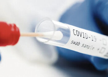 Mokyklose – besiformuojantys COVID – 19 židiniai