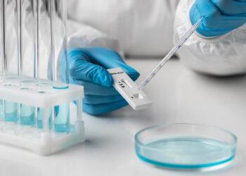 Mažėjantys COVID-19 sergamumo ir augantys liekamųjų reiškinių skaičiai