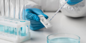 Mažėjantys COVID-19 sergamumo ir augantys liekamųjų reiškinių skaičiai