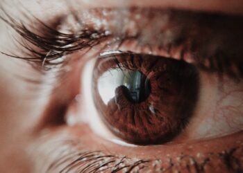 Pagrindinės akių problemos ir jų priežastys