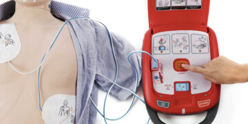 Svarsto apie defibriliatoriaus įsigijimą