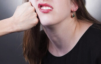 Per muštynes nukentėjo nepilnametė