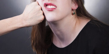 Per muštynes nukentėjo nepilnametė