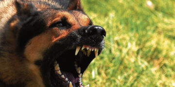 Šuo šiurpiai išdraskė žmogaus veidą