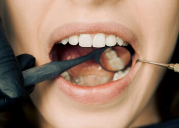 Dantų implantai: Privalumai ir trūkumai