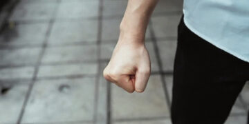 Sumuštas futbolininkas – Kauno klinikose