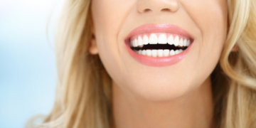 Periodontitas. Ką turėtumėte žinoti apie šią tylią dantenų ligą?