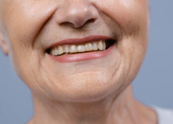 Kodėl senstant dantys tampa silpnesni?