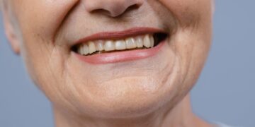 Kodėl senstant dantys tampa silpnesni?