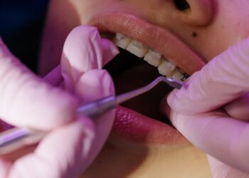 Ar breketai gali sumažinti naktinį dantų griežimą?