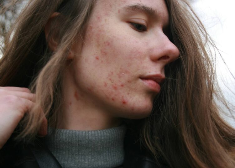 Dermatologas turėtų apžiūrėti net ir nedidelius odos pokyčius, tad neatidėliokite vizito
